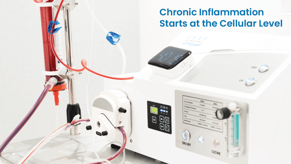 Chronic Inflammation: Could EBOO Therapy Help Support Your Body’s Natural Healing Response?